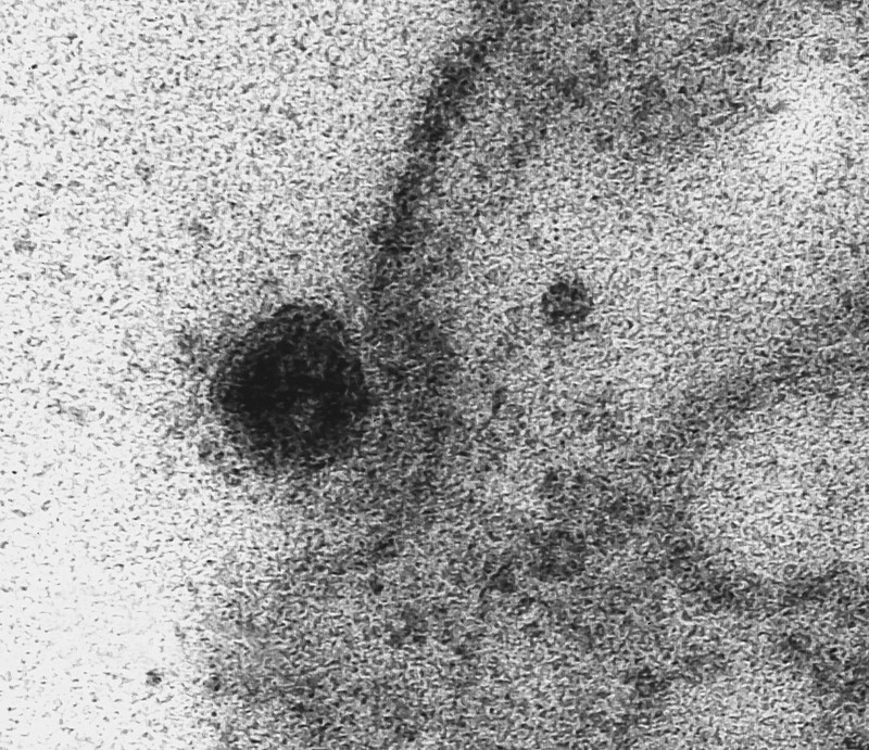 Particulele virale au început procesul de infectare a celulei FOTO: EPA