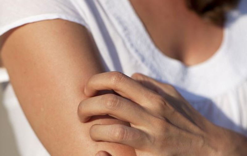 Neurodermatita îți poate afecta viața sexuală