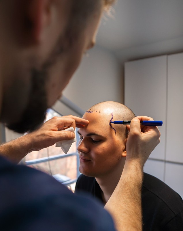 David, fiul cel mare al Ancăi Serea, și-a făcut transplant de păr la Cluj. Imagini din cabinetul medicului