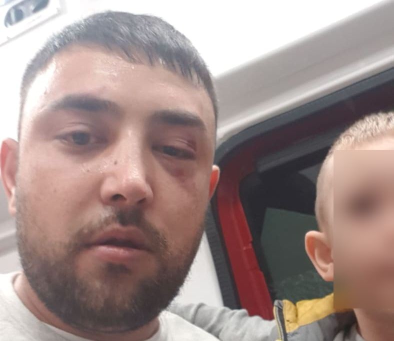Marius Predescu (27 de ani) susține că a fost bătut de bodyguarzii lui Remus Rădoi