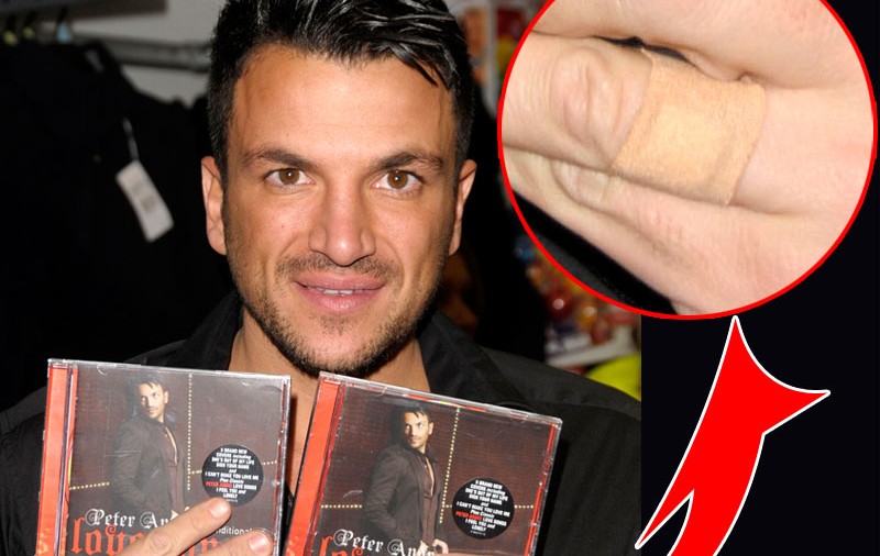 Peter Andre îşi şterge tatuajul cu Katie de pe deget