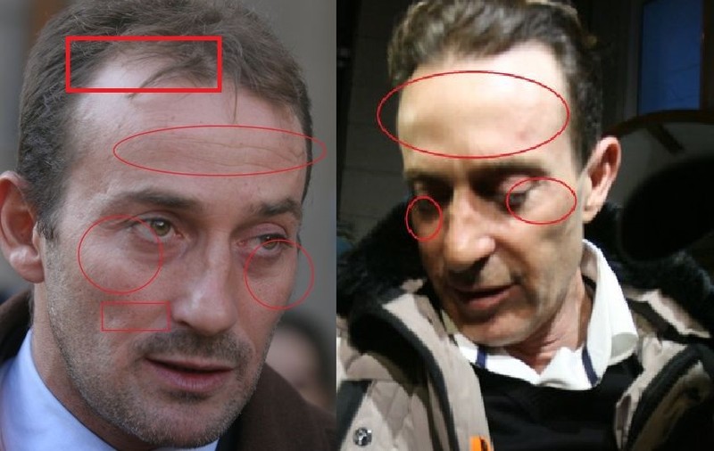 Mazăre, un primar ”tunat”. Operațiile estetice care l-au schimbat pe edilul Constanței