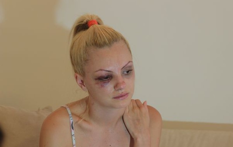 EXCLUSIV. PROBLEMELE CONTINUĂ pentru Alexandra Stan. Artista este INTERNATĂ DIN NOU ÎN SPITAL