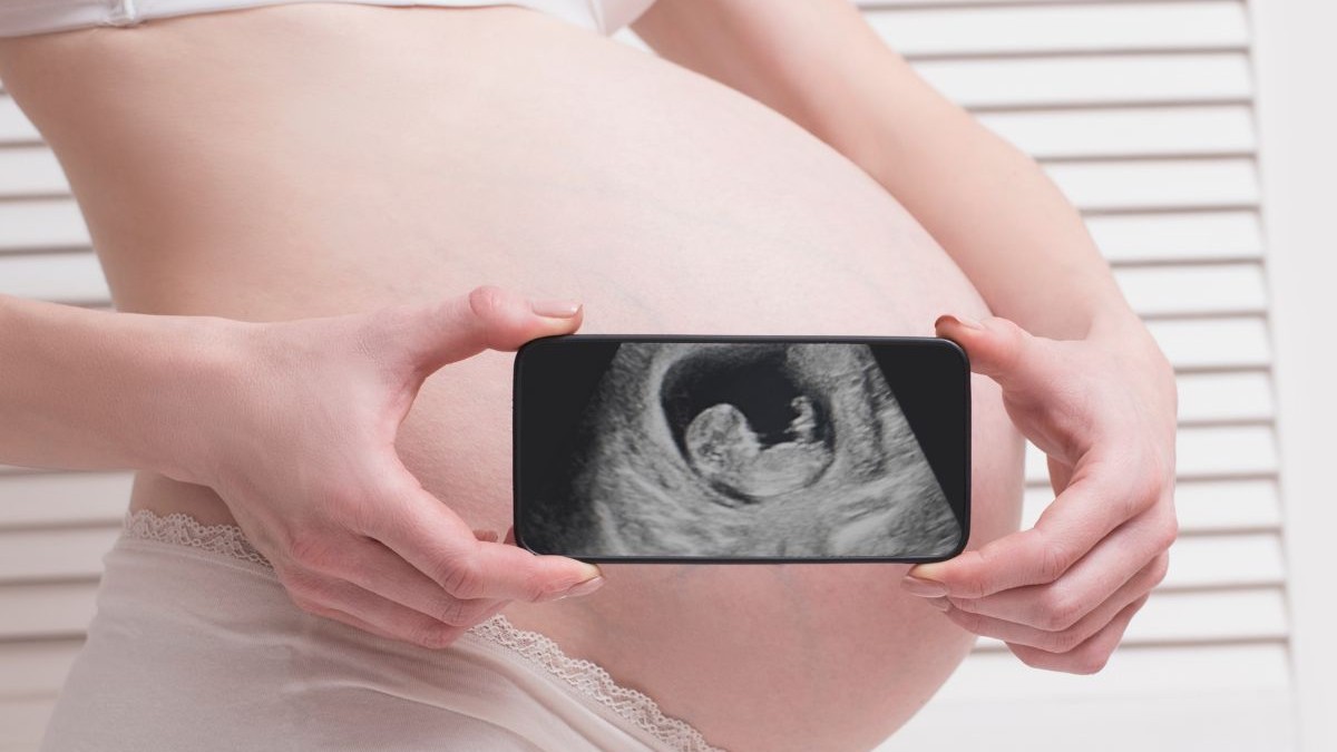Femeie însărcinată în lenjerie intimă, ținând și arătând un smartphone cu o fotografie ecografică a fătului pe un fundal alb din lemn.